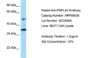 Western Blotting (WB) image for anti-Patatin-Like phospholipase Domain Containing 2 (PNPLA2) (Middle Region) antibody (ABIN2787884)