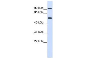 LOXL1 antibody used at 1 ug/ml to detect target protein. (LOXL1 Antikörper  (Middle Region))