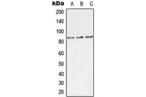 Western blot analysis of TLK1 (pS743) expression in MCF7 (A), rat brain (B), H9C2 (C) whole cell lysates. (TLK1 Antikörper  (C-Term, pSer743))