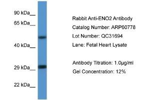 Western Blotting (WB) image for anti-Enolase 2 (Gamma, Neuronal) (ENO2) (N-Term) antibody (ABIN786270) (ENO2/NSE Antikörper  (N-Term))