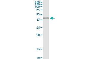 Immunoprecipitation (IP) image for anti-Microtubule-Associated Protein, RP/EB Family, Member 2 (MAPRE2) (AA 1-327) antibody (ABIN524382)