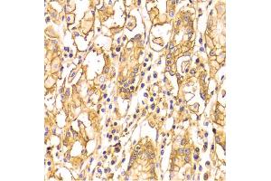 Immunohistochemistry of paraffin-embedded human stomach using BSG Antibody (ABIN5970747) at dilution of 1/100 (40x lens). (CD147 Antikörper)