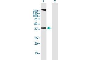 Western Blot analysis of LASS3 expression in transfected 293T cell line by LASS3 MaxPab polyclonal antibody. (LASS3 Antikörper  (AA 1-383))