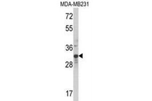 Western blot analysis of MLX Antibody (Center) in MDA-MB231 cell line lysates (35ug/lane). (MLX Antikörper  (Middle Region))