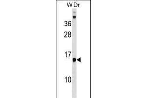 DAD1 Antibody (C-term) (ABIN1537513 and ABIN2849048) western blot analysis in WiDr cell line lysates (35 μg/lane).