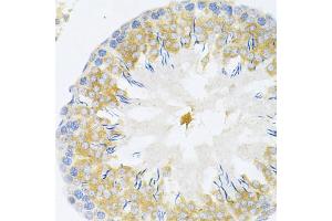 Immunohistochemistry of paraffin-embedded rat testis using TAPBP Antibody (ABIN1875423) at dilution of 1:200 (40x lens). (TAPBP Antikörper)