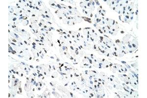 Matrin 3 antibody was used for immunohistochemistry at a concentration of 4-8 ug/ml to stain Skeletal muscle cells (arrows) in Human Muscle.