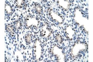 THOC4 antibody was used for immunohistochemistry at a concentration of 4-8 ug/ml to stain Alveolar cells (arrows) in Human Lung.