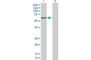 Western Blot analysis of DVL1 expression in transfected 293T cell line by DVL1 MaxPab polyclonal antibody. (DVL1 Antikörper  (AA 1-444))