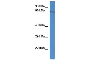 WB Suggested Anti-Tyrp1 Antibody   Titration: 1. (Tyrosinase-Related Protein 1 Antikörper  (C-Term))