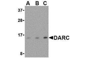 Western blot analysis of DARC in PC-3 cell lysate with AP30274PU-N DARC antibody at (A) 0. (DARC Antikörper  (N-Term))