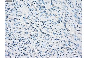 Immunohistochemical staining of paraffin-embedded endometrium tissue using anti-SLC2A5mouse monoclonal antibody. (SLC2A5 Antikörper)