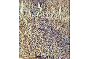 MEF2A Antibody immunohistochemistry analysis in formalin fixed and paraffin embedded human tonsil tissue followed by peroxidase conjugation of the secondary antibody and DAB staining. (MEF2A Antikörper  (AA 453-479))