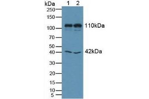Figure. (MIB1 Antikörper  (AA 769-1000))