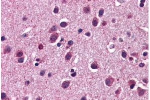 Human Brain, Cortex: Formalin-Fixed, Paraffin-Embedded (FFPE) (HTR3C Antikörper  (AA 360-409))