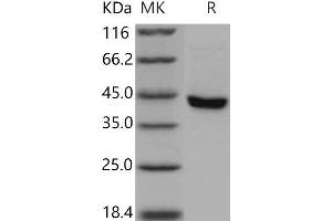 SERPINB8 Protein (His tag)