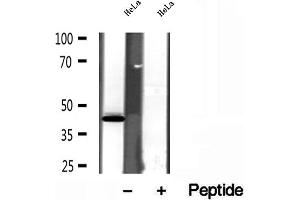 Western blot analysis of extracts of HeLa cells, using SPOP antibody. (SPOP-B Antikörper  (Internal Region))