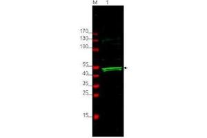 Image no. 1 for anti-Protein S (PROS) (AA 16-25) antibody (ABIN199929) (PROS1 Antikörper  (AA 16-25))