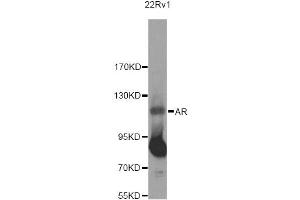 Western blot analysis of extracts of 22RV1 cells, using AR Antibody (ABIN5971084) at 1/500 dilution. (Androgen Receptor Antikörper)