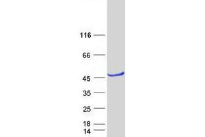ACBD4 Protein (Transcript Variant 2) (Myc-DYKDDDDK Tag)