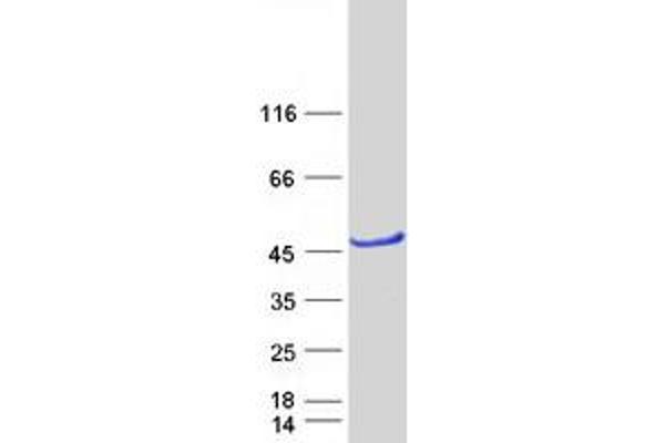 ACBD4 Protein (Transcript Variant 2) (Myc-DYKDDDDK Tag)