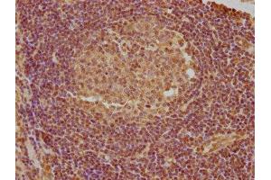 IHC image of ABIN7144464 diluted at 1:740 and staining in paraffin-embedded human lymph node tissue performed on a Leica BondTM system.