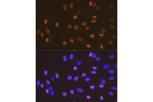 Immunofluorescence analysis of C6 cells using SOX10 Rabbit mAb (ABIN7270567) at dilution of 1:100 (40x lens).