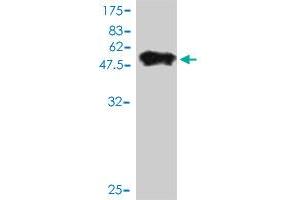 Western Blotting (WB) image for anti-RAB4A, Member RAS Oncogene Family (RAB4A) (AA 1-218) antibody (ABIN562558)
