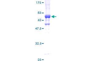 Image no. 2 for serine/threonine Kinase 32C (STK32C) (AA 1-369) protein (GST tag) (ABIN1321692) (STK32C Protein (AA 1-369) (GST tag))
