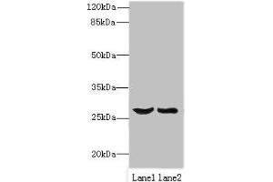Western blot All lanes: OCIAD1 antibody at 1 μg/mL Lane 1: Mouse liver tissue Lane 2: Mouse kidney tissue Secondary Goat polyclonal to rabbit IgG at 1/10000 dilution Predicted band size: 28, 21, 22 kDa Observed band size: 28 kDa (OCIAD1 Antikörper  (AA 1-245))