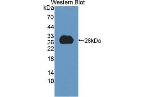 Detection of Recombinant HDLBP, Human using Polyclonal Antibody to High Density Lipoprotein Binding Protein (HDLBP)