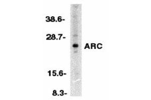 Western Blotting (WB) image for anti-ARC (N-Term) antibody (ABIN1031239) (ARC (N-Term) Antikörper)