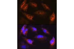 Immunofluorescence analysis of U-251MG cells using  Rabbit pAb (ABIN6131182, ABIN6136830, ABIN6136831 and ABIN6222940) at dilution of 1:100 (40x lens). (ALS2 Antikörper  (AA 1-280))