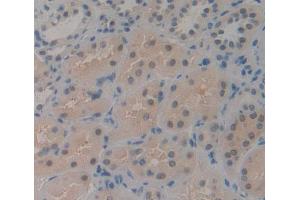 Used in DAB staining on fromalin fixed paraffin- embedded kidney tissue (CDK2AP1 Antikörper  (AA 1-115))