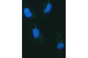 IF analysis of YKL-40/CHI3L1 using anti-YKL-40/CHI3L1 antibody (ABIN7599648).