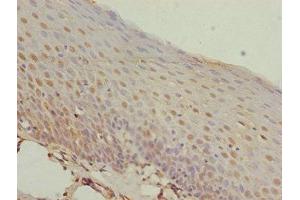Immunohistochemistry of paraffin-embedded human tonsil tissue using ABIN7155798 at dilution of 1:100 (MEOX1 Antikörper  (AA 1-254))