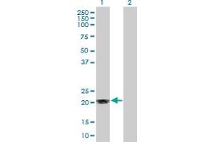Western Blot analysis of MGMT expression in transfected 293T cell line by MGMT MaxPab polyclonal antibody. (MGMT Antikörper  (AA 1-207))