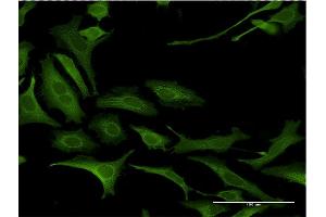Immunofluorescence of monoclonal antibody to NDN on HeLa cell. (NDN Antikörper  (AA 222-321))