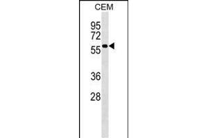 PI4K2A Antibody (C-term) (ABIN1537244 and ABIN2848598) western blot analysis in CEM cell line lysates (35 μg/lane).