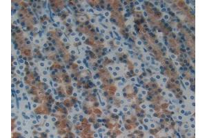 DAB staining on IHC-P; Samples: Rat Stomach Tissue (Hepcidin Antikörper  (AA 23-84))