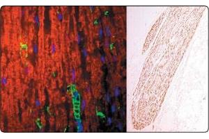 In the Left panel (a tissue section through an adult sciatic nerve), Po (green staining) can be seen in the myelin and Schwann cell processes surrounding the nodes of Ranvier. (MPZ Antikörper)