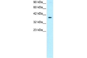 WB Suggested Anti-NT5C3 Antibody Titration:  0. (NT5C3 Antikörper  (Middle Region))