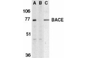 Image no. 1 for anti-Beta-secretase 1 (BACE1) (C-Term) antibody (ABIN204488) (BACE1 Antikörper  (C-Term))