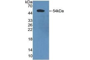 Detection of Recombinant PDCD6IP, Human using Polyclonal Antibody to Programmed Cell Death Protein 6 Interacting Protein (PDCD6IP)