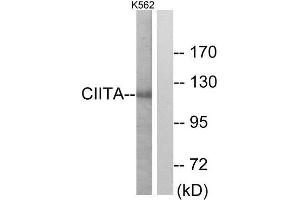 Western Blotting (WB) image for anti-Class II, Major Histocompatibility Complex, Transactivator (CIITA) (Internal Region) antibody (ABIN1849325) (CIITA Antikörper  (Internal Region))