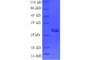 SDS-PAGE (SDS) image for Mannose-Binding Lectin (Protein C) 2, Soluble (MBL2) (AA 21-248) protein (His tag) (ABIN5713636)
