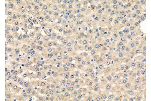 ABIN6262035 and ABIN6279448 at 1/100 staining Rat liver tissue by IHC-P.