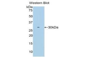 Detection of Recombinant ITLN1, Mouse using Polyclonal Antibody to Intelectin 1 (ITLN1) (ITLN1/Omentin Antikörper  (AA 28-270))