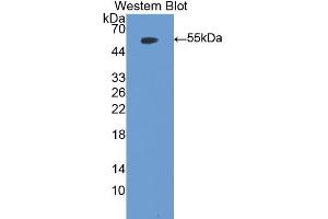 Western blot analysis of the recombinant protein. (Myeloperoxidase Antikörper  (AA 253-718))