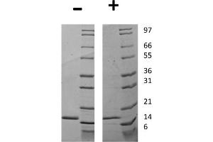 SDS-PAGE of Human Granulocyte Colony Stimulating Factor Recombinant Protein SDS-PAGE of Human Granulocyte Colony Stimulating Factor Recombinant Protein. (G-CSF Protein)